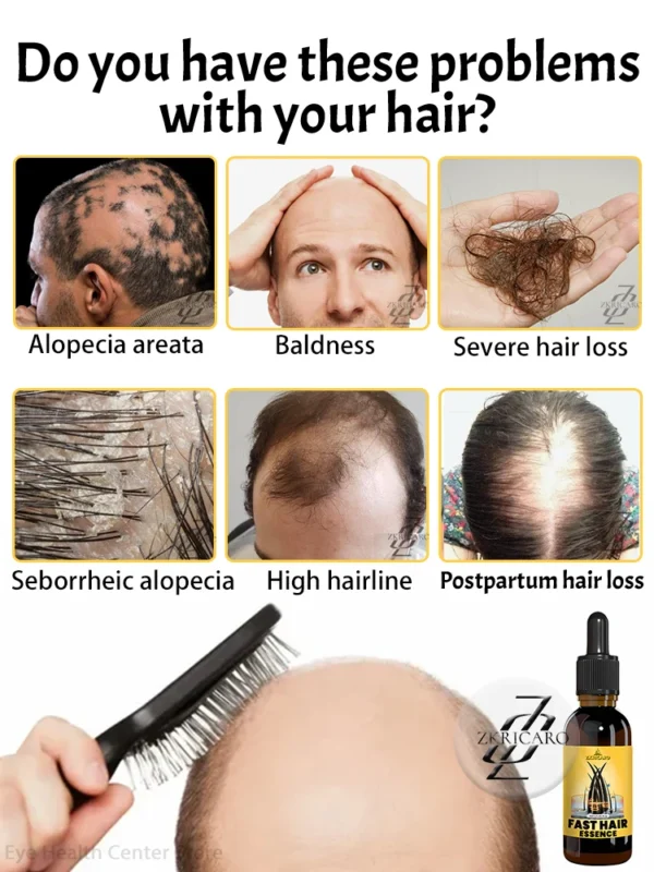 2025 Hair growth oil, repair baldness, hairline, seborrheic alopecia, rapid hair growth - Image 4