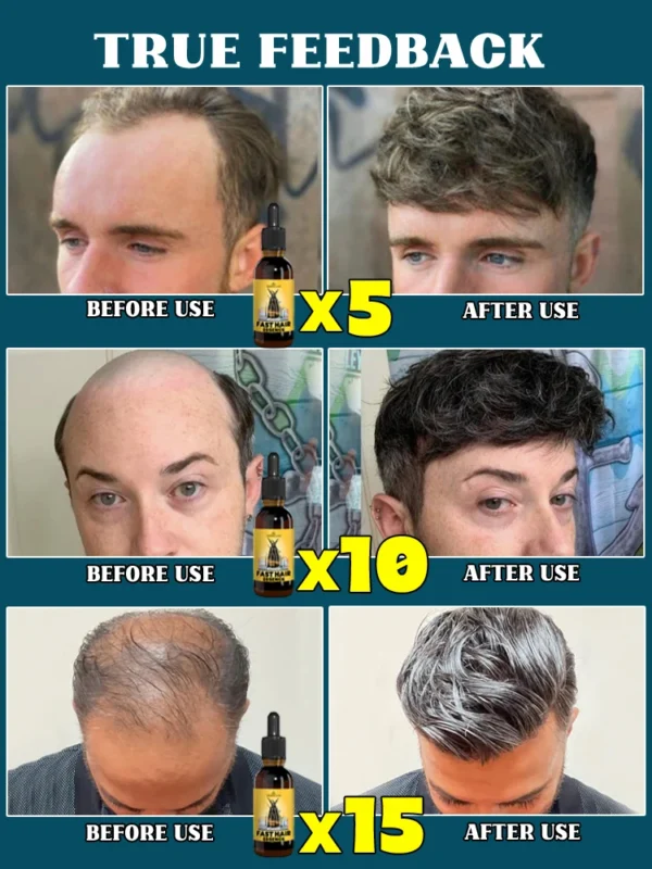 2025 Hair growth oil, repair baldness, hairline, seborrheic alopecia, rapid hair growth - Image 3